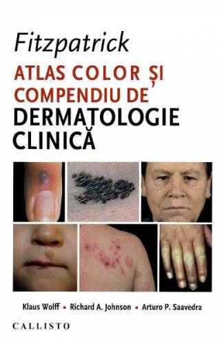 Fitzpatrick Atlas color si compendiu de dermatologie clinica - Klaus Wolff